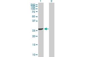 Western Blot analysis of DCK expression in transfected 293T cell line by DCK MaxPab polyclonal antibody. (DCK 抗体  (AA 1-260))