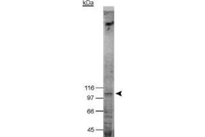 Western blot analysis of NOD2 in NOD2 transfected HEK 293T (Bosc 23) cell lysate with NOD2 monoclonal antibody, clone 2D9 . (NOD2 抗体  (AA 28-301))