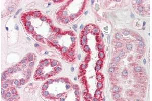 Image no. 2 for anti-Plastin 3 (PLS3) (AA 503-552) antibody (ABIN6749763) (Plastin 3 抗体  (AA 503-552))