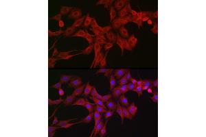 Immunofluorescence analysis of PC-12 cells using LTBR Rabbit pAb (ABIN6129412, ABIN6143379, ABIN6143381 and ABIN6220987) at dilution of 1:200 (40x lens). (LTBR 抗体  (AA 31-227))