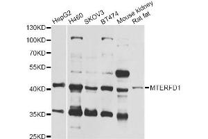 Western blot analysis of extracts of various cell lines, using MTERFD1 antibody (ABIN6293949) at 1:1000 dilution. (MTERFD1 抗体)