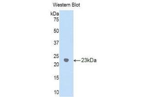 Western Blotting (WB) image for anti-gamma Glutamyltransferase 1 (GGT1) (AA 122-299) antibody (ABIN1859003) (GGT1 抗体  (AA 122-299))