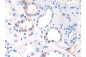 Detection of TAF1 in Human Kidney Tissue using Polyclonal Antibody to TATA Box Binding Protein Associated Factor 1 (TAF1)