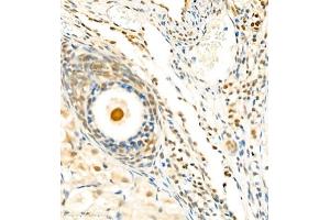 Immunohistochemistry of paraffin embedded mouse ovary using Skar (ABIN7074970) at dilution of 1:1800 (400x lens) (p46 抗体)