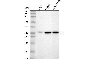 Western blot analysis of GLUL using anti-GLUL antibody (ABIN7602403).