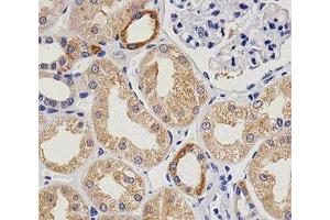 Immunohistochemical analysis of paraffin-embedded human kidney using vWF at 1:25 dilution. (VWF 抗体)
