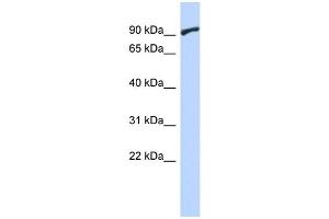 WB Suggested Anti-ZNF337 Antibody Titration:  0. (ZNF337 抗体  (Middle Region))