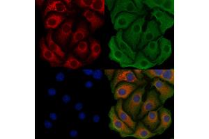 ABIN6259741 and ABIN6279518 staining Hela cells by IF/ICC. (Acsl3 抗体  (Internal Region))