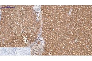 Immunohistochemistry of paraffin-embedded Human liver tissue using COL3A1 Monoclonal Antibody at dilution of 1:200. (COL3A1 抗体)