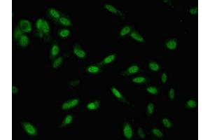 Immunofluorescent analysis of Hela cells using ABIN7171071 at dilution of 1:100 and Alexa Fluor 488-congugated AffiniPure Goat Anti-Rabbit IgG(H+L)
