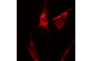 ABIN6275263 staining 293 cells by IF/ICC. (Myosin 抗体  (Internal Region))