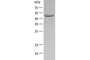 Western Blotting (WB) image for Carboxypeptidase E (CPE) (AA 43-476) protein (His tag) (ABIN7122142) (CPE Protein (AA 43-476) (His tag))