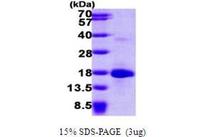 SDS-PAGE (SDS) image for LSM4 Homolog, U6 Small Nuclear RNA Associated (LSM4) (AA 1-139) protein (His tag) (ABIN667317) (LSM4 Protein (AA 1-139) (His tag))