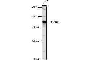 Western blot analysis of extracts of HeLa cells, using LML antibody (ABIN7268204) at 1:1000 dilution. (LMAN2L 抗体)