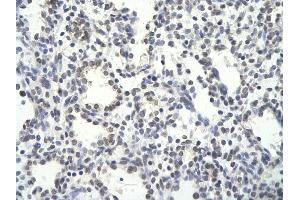 Immunohistochemistry (IHC) image for anti-Proteasome (Prosome, Macropain) 26S Subunit, Non-ATPase, 14 (PSMD14) (N-Term) antibody (ABIN2779653)