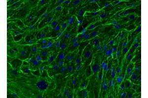 Immunofluorescent analysis of Fibronectin in mesenchymal stem cells (MSC). (Fibronectin 抗体)