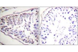 Immunohistochemistry analysis of paraffin-embedded human tonsil tissue, using HSL (Ab-552) Antibody. (LIPE 抗体  (AA 518-567))