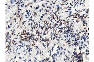 Immunohistochemical staining of paraffin-embedded Human prostate tissue using anti-MICAL1 mouse monoclonal antibody. (MICAL1 抗体)
