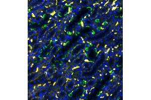IF analysis of SLC4A1 using anti-SLC4A1 antibody (ABIN3043930) SLC4A1 was detected in paraffin-embedded section of rat kidney tissues.