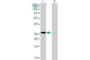 Western Blot analysis of SFRS9 expression in transfected 293T cell line by SFRS9 MaxPab polyclonal antibody. (SFRS9 抗体  (AA 1-221))