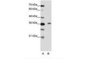 Image no. 2 for anti-BTB (POZ) Domain Containing 6 (BTBD6) (AA 87-136) antibody (ABIN202456) (BTBD6 抗体  (AA 87-136))
