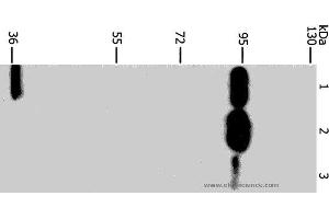 Western blot analysis of Mouse stomach tissue, 293T and Jurkat cell, using PLA2G4B Polyclonal Antibody at dilution of 1:1400 (PLA2G4B 抗体)