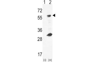 Western Blotting (WB) image for anti-Glucokinase (Hexokinase 4) (GCK) antibody (ABIN5023820) (GCK 抗体)