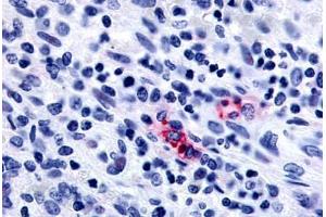 Anti-P2RY13 / P2Y13 antibody  ABIN1049213 IHC staining of human spleen. (Purinergic Receptor P2Y, G-Protein Coupled, 13 (P2RY13) (Extracellular Domain) 抗体)