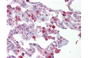 Anti-FOSL1 / FRA1 antibody IHC of human lung. (FOSL1 抗体  (AA 143-192))