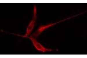 ABIN6275362 staining HeLa cells by IF/ICC. (Plakophilin 2 抗体  (N-Term))