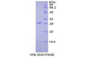 SDS-PAGE analysis of Cow UCHL5 Protein. (UCHL5 Protein (C-Term))