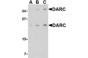 Western blot analysis of DARC in mouse brain tissue lysate with AP30273PU-N DARC antibody at (A) 0. (DARC 抗体  (C-Term))