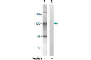 Western blot analysis of extracts from HUVEC cells, using AZI1 polyclonal antibody . (AZI1 抗体)