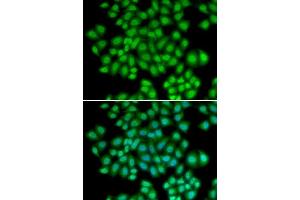 Immunofluorescence (IF) image for anti-Activating Transcription Factor 2 (ATF2) (AA 1-190) antibody (ABIN3023064)