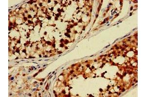 Immunohistochemistry of paraffin-embedded human testis tissue using ABIN7150681 at dilution of 1:100 (PDE11A 抗体  (AA 42-190))