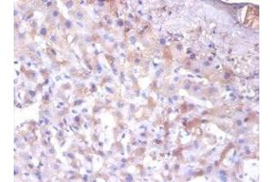 Immunohistochemistry of paraffin-embedded human liver tissue using ABIN7151681 at dilution of 1:100 (ERP29 抗体  (AA 40-251))