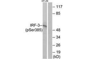 Western blot analysis of extracts from HT29 cells treated with INSULIN 0. (IRF3 抗体  (pSer385))