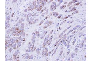 IHC-P Image Immunohistochemical analysis of paraffin-embedded MDAMB468 xenograft , using phospholipid scramblase 1, antibody at 1:500 dilution. (PLSCR1 抗体)