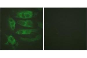 Immunofluorescence (IF) image for anti-Adrenergic, beta-2-, Receptor, Surface (ADRB2) (AA 321-370) antibody (ABIN2888906) (beta 2 Adrenergic Receptor 抗体  (AA 321-370))