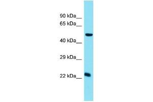 Host: Rabbit  Target Name: Chmp5  Sample Tissue: Mouse Small Intestine lysates  Antibody Dilution: 1. (CHMP5 抗体  (C-Term))
