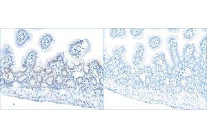 anti-Replication Protein A2, 32kDa (RPA2) (pSer4), (pSer8) antibody