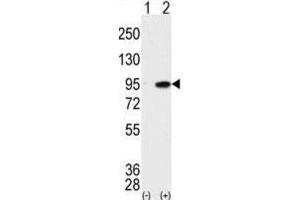 Western Blotting (WB) image for anti-Male Germ Cell-Associated Kinase (MAK) antibody (ABIN3003276) (MAK 抗体)
