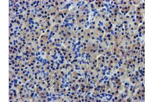Immunohistochemical staining of paraffin-embedded Human pancreas tissue using anti-LPL mouse monoclonal antibody. (Lipoprotein Lipase 抗体  (AA 28-475))