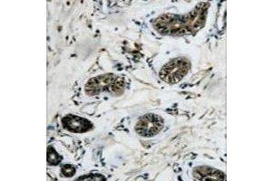 Immunohistochemical analysis of Beta-tubulin staining in human colon formalin fixed paraffin embedded tissue section. (TUBB 抗体)