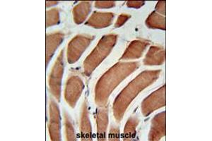 SIKE Antibody immunohistochemistry analysis in formalin fixed and paraffin embedded human skeletal muscle followed by peroxidase conjugation of the secondary antibody and DAB staining. (SIKE1 抗体  (C-Term))