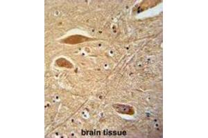 Immunohistochemistry (IHC) image for anti-Fibrinogen beta Chain (FGB) antibody (ABIN3002657) (Fibrinogen beta Chain 抗体)