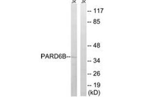 Western blot analysis of extracts from Jurkat cells, using PARD6B Antibody. (PARD6B 抗体  (AA 233-282))