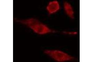 ABIN6275681 staining  HuvEc cells by IF/ICC. (WEE2 抗体)