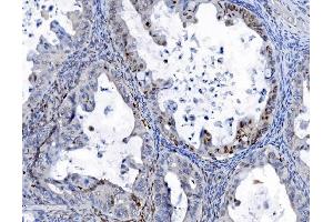 IHC analysis of SAMHD1 using anti-SAMHD1 antibody (ABIN7601515).