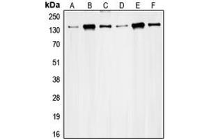 Western blot analysis of RAD50 expression in HeLa (A), K562 (B), Jurkat (C), MCF7 (D), Ramos (E), SW480 (F) whole cell lysates. (RAD50 抗体  (Center))